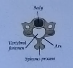 <p>Body, vertebral foramen, ars/lamina, spinous process </p>