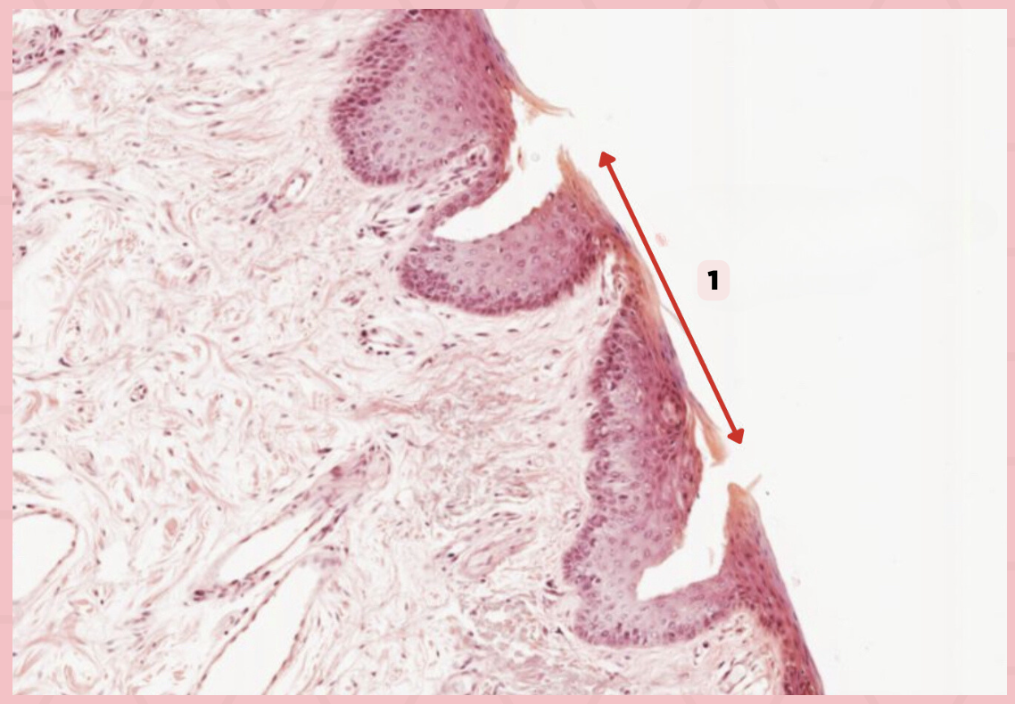 <p>What specimen is being showed in the picture?</p>