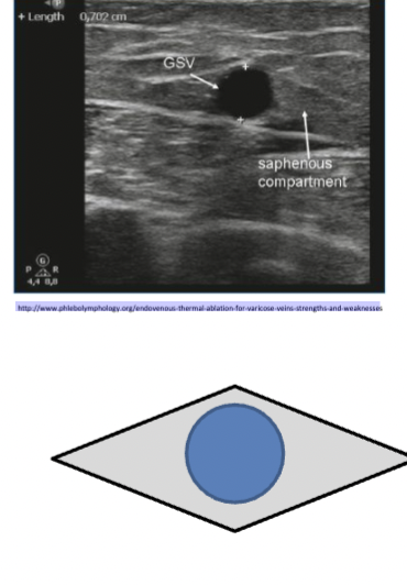 <p>Where are the superficial veins located. </p>