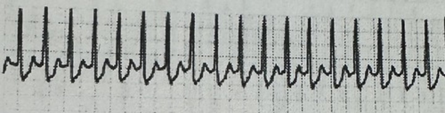 <p>identify the rhythm</p>