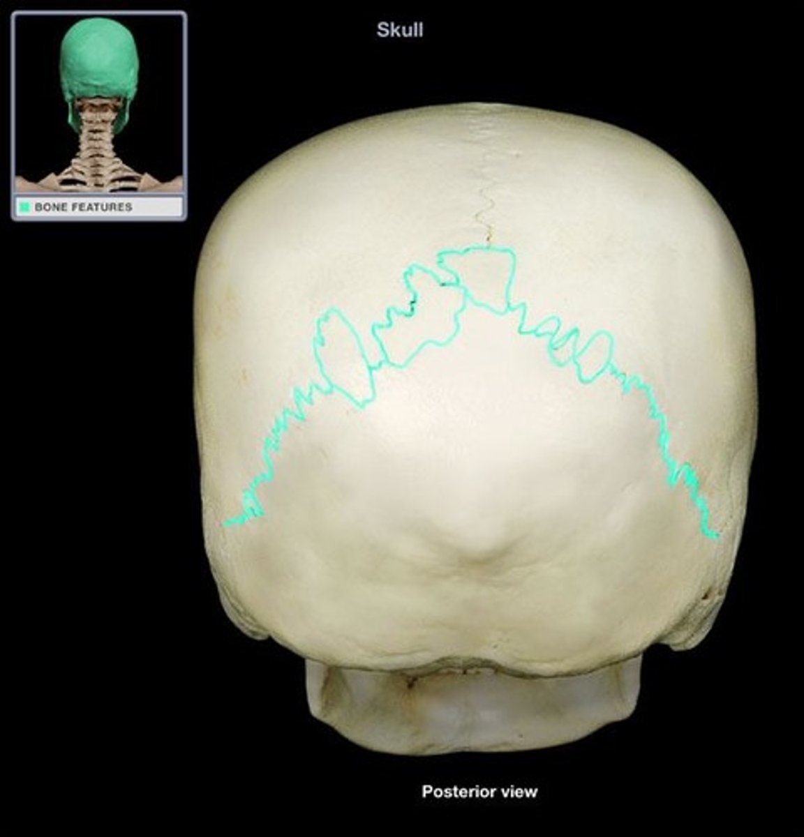 <p>between occipital and parietal bones</p>