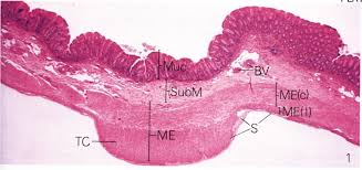 <p>Organ?</p><p>Bump looking structure on outside? Found where?</p>