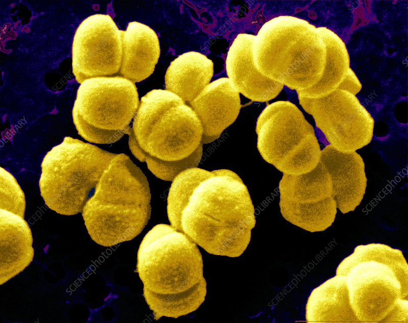 <p>ID this cell morphology arrangement</p>
