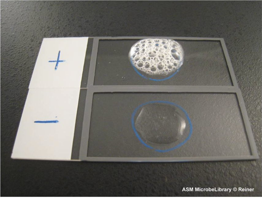 <p>The biochemical test in the image is used to detect the presence of an enzyme that converts hydrogen peroxide into water and oxygen. Using your knowledge of the test and the observed results, name the enzyme.</p><ul><li><p>catalase</p></li><li><p>lipase</p></li><li><p>coagulase&nbsp;</p></li><li><p>oxidase&nbsp;</p></li></ul><p></p>