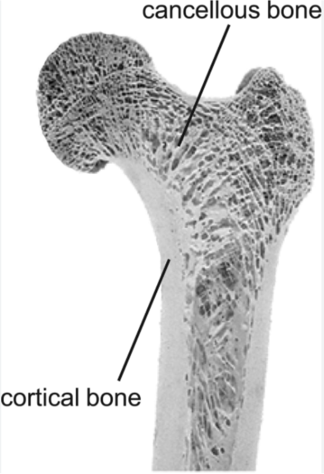 <p>(Spongy Bone, Trabecular Bone) Type of bone tissue characterized by its porous, honeycomb-like structure composed of interconnected rods and plates called TRABECULAE. It is found at the ends of long bones, in the pelvis, ribs, vertebrae and skull and houses red bone marrow</p>