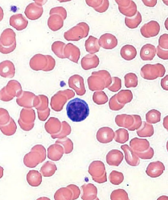 <p><strong>agranular leukocytes: lymphocytes</strong></p><ul><li><p>nuclei round or indented and stain dark</p><ul><li><p>cytoplasm stains blue</p></li></ul></li><li><p><u>acquired immunity</u></p><ul><li><p>T cells → helper, cytotoxic, suppressor</p></li><li><p>B cells → plasma cells</p></li></ul></li><li><p><u>innate immunity</u></p><ul><li><p>natural killer cells</p></li></ul></li><li><p>never _______</p></li><li><p>small (90%) vs. large (10% lymphocytes)</p></li><li><p>~25% of WBCs</p></li></ul><p></p>