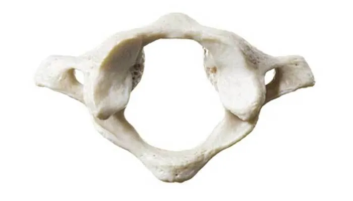 <p>C1, first cervical vertebrae  </p>
