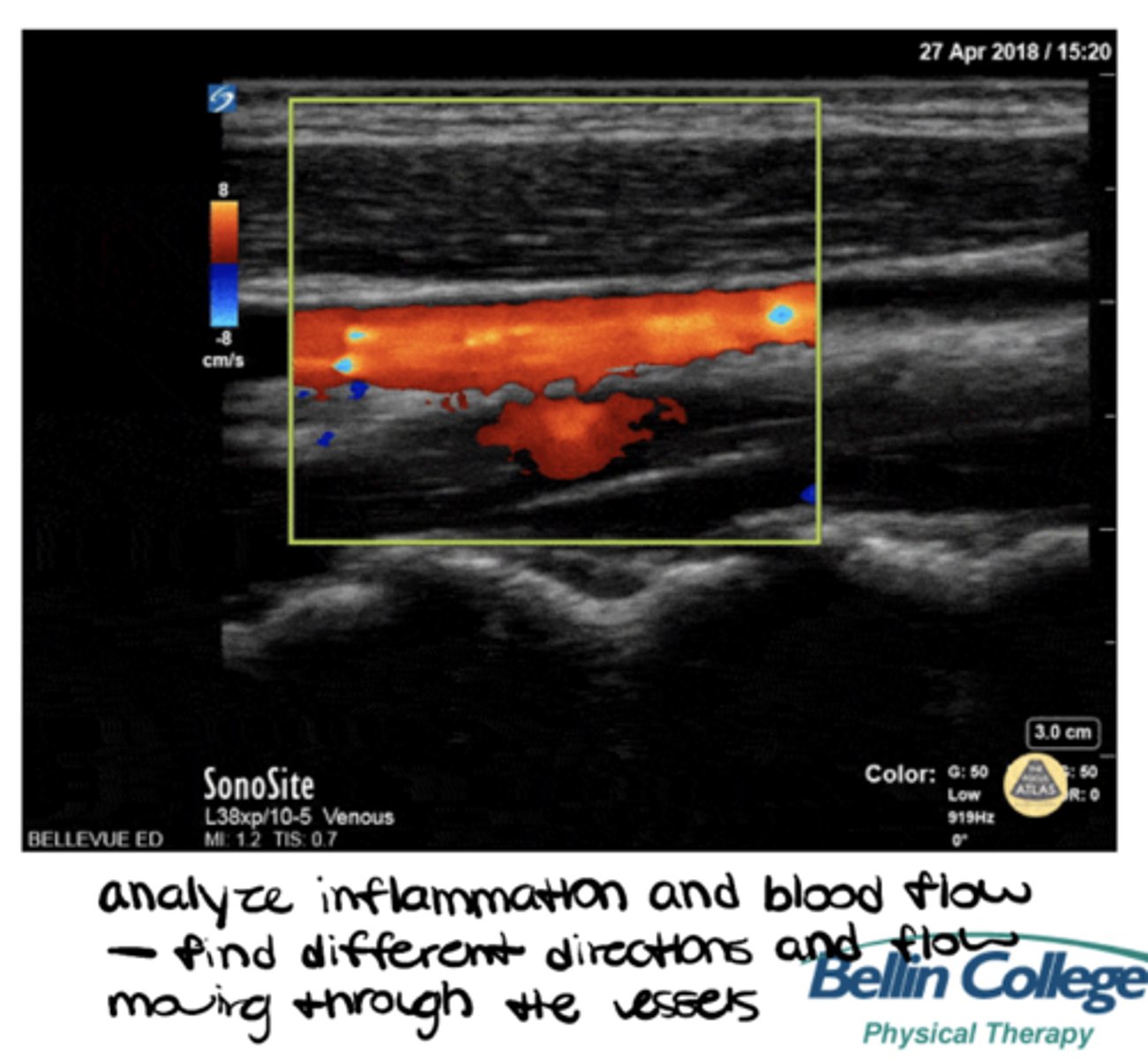 <p>Doppler (fluid mode)</p>