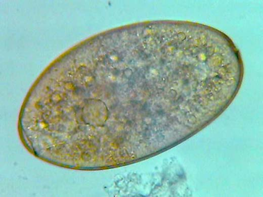 <p>cattle, sheep, and other ruminants I. host 1st aquatic snail 2nd none cercariae encyst on aquatic vegetation bile duct necropsy clorsulon liver fluke liver rot ZOONOTIC</p>
