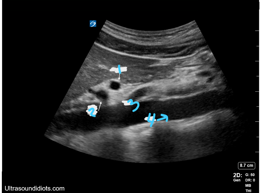 <p>In this sagittal view, what is #1?</p>