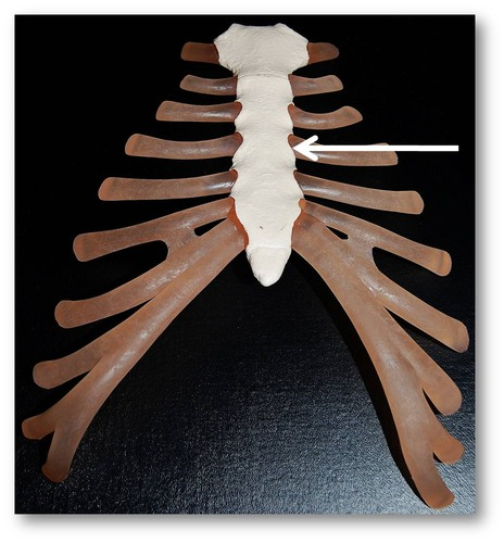 <p>Breastbone. Composed of three fused bones- manubrium, the body, and xiphoid process. It is attached to the first 7 pairs of ribs</p>