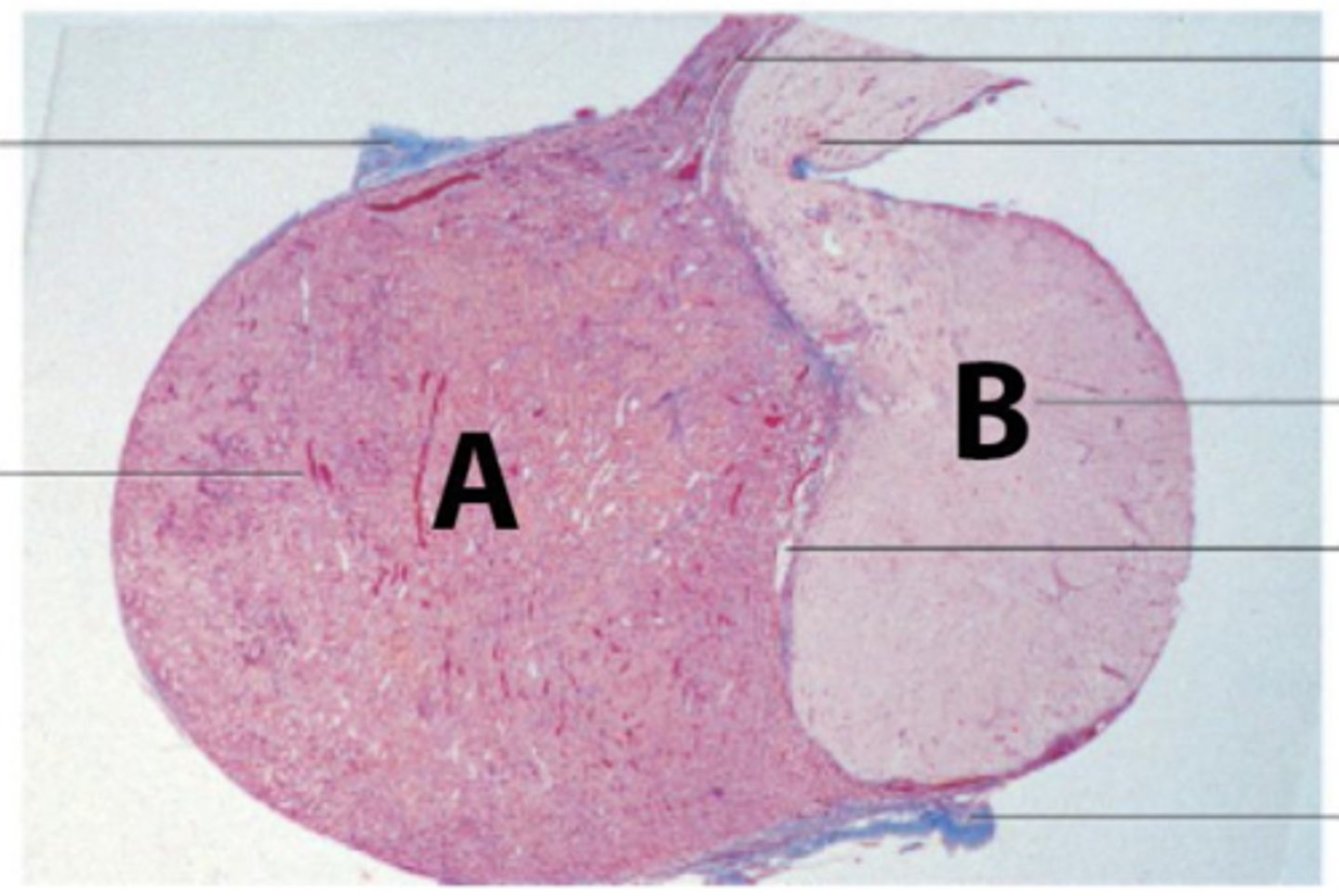 <p>A 42-year-old female presents in the ER with shock, due to postpartum hemorrhage, following a normal delivery at home. Her blood pressure was undetectable, pulse rate was 130 per minute, and extremities were cold. Immediate care involved vascular expansion with colloids via a central venous catheter, followed by transfusion of packed red cells. The short-term evolution was marked by lactation failure, agitation, and convulsions. The medium-term evolution was marked by prolonged amenorrhea, fatigue, and apathy.</p><p>The patient is suffering from Sheehan's syndrome, which is characterized by partial or complete necrosis of this organ (shown in the picture) in women with severe blood loss and hypotension during delivery.</p><p>What is this organ?</p>