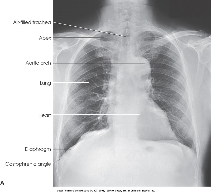<p>What position is demonstrated?</p>