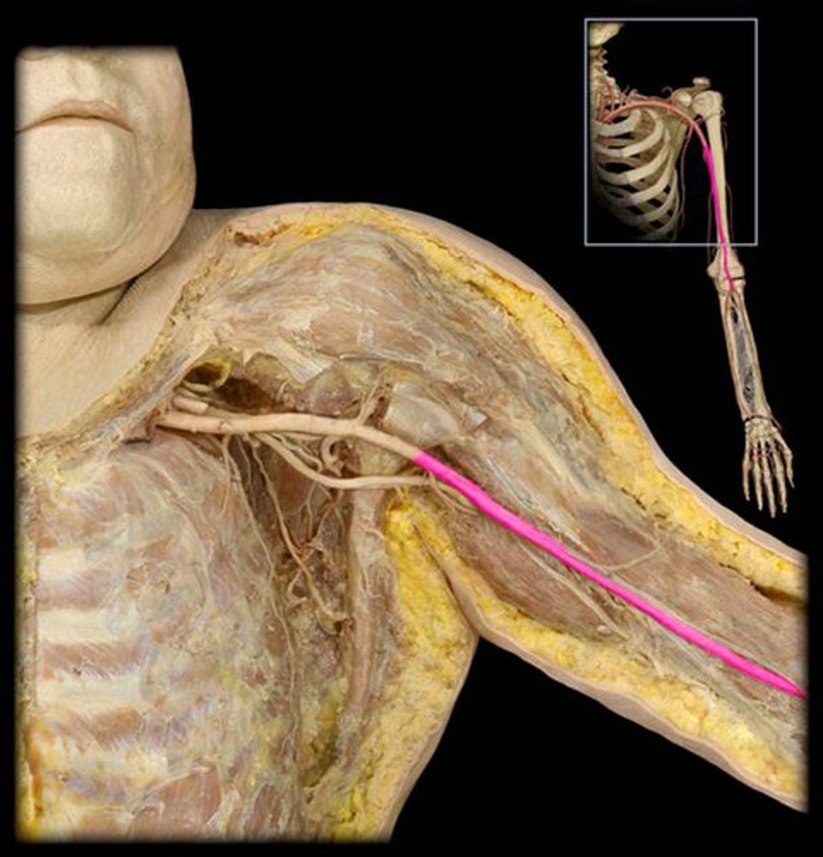 <p>Name this vessel.</p>