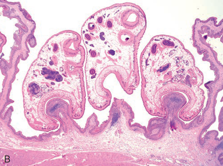 <p>A-Duodenum</p><p>Paramphistomum cervi; Larval paramphistomes in the duodenum</p><p>can cause disease</p>
