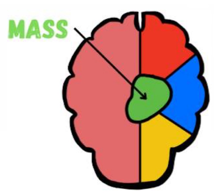 <p>intracranial components can initially compensate for extra volume while the ICP remains normal </p><p></p><p>CSF and venous blood can be compressed, providing a degree of <strong><u>pressure buffering</u></strong> </p>
