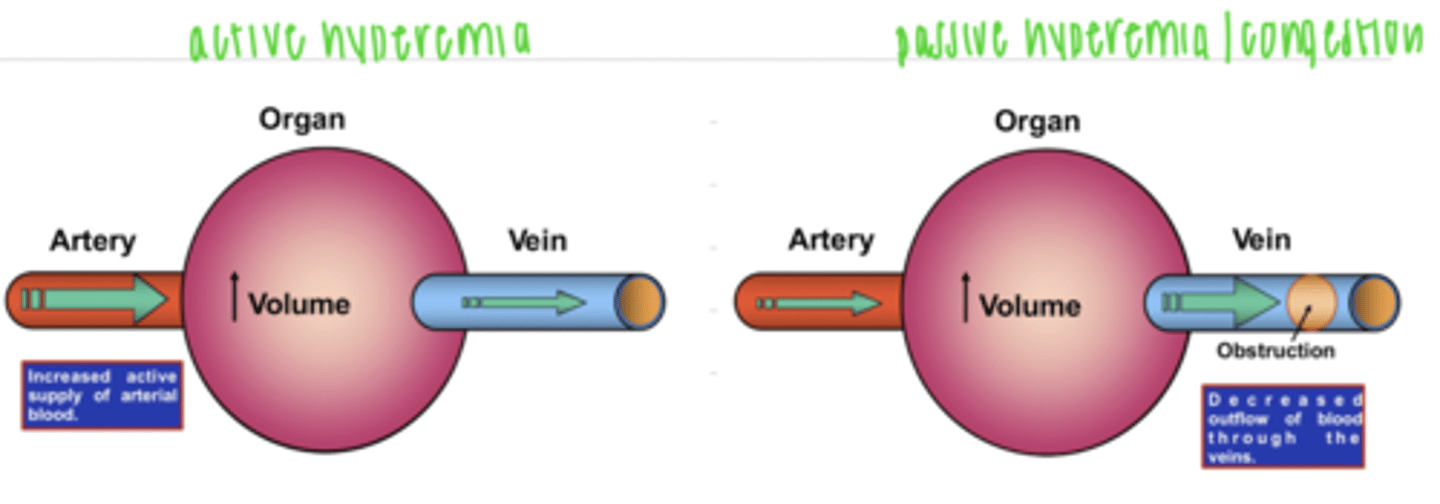 <p>the increase of blood in a specific area of the body due to an increased arterial blood flow</p>