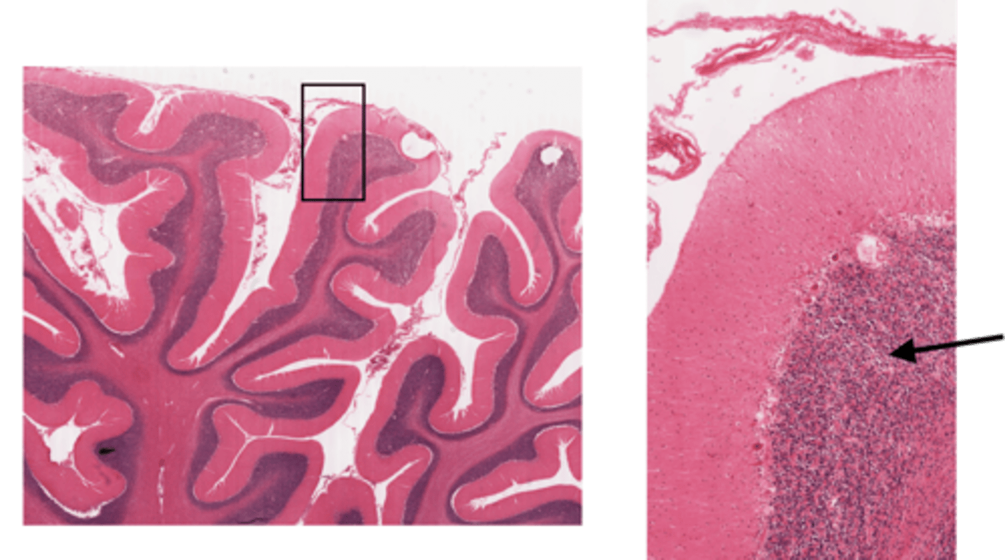 <p>Identify the layer of the cerebellum</p>