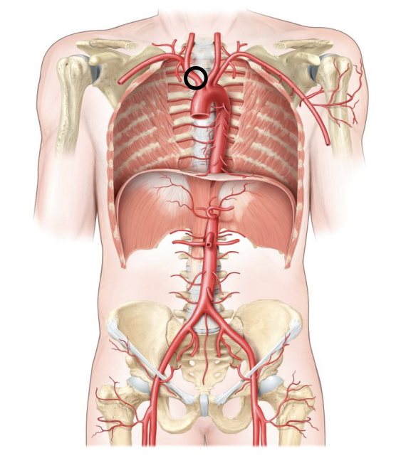 <p>The first branch of the aorta that supplies the right side of the head, neck, and arm.</p>