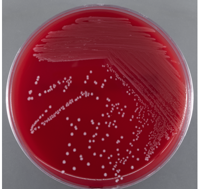 <ul><li><p>no damage to RBCs (no change to agar)</p></li><li><p>S. mutans and group D strep</p></li></ul><p></p>