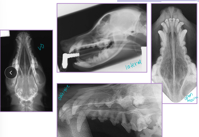 <ul><li><p>Check occlusion!!</p></li><li><p><span style="background-color: transparent;"><strong><span>Considerations: </span></strong></span></p><ul><li><p><span style="background-color: transparent;"><strong><span>Body</span></strong><span>: bending forces, </span><strong><span>tension greatest at alveolar surface</span></strong></span></p></li><li><p><span style="background-color: transparent;"><strong><span>Ramus</span></strong><span>: shear forces</span></span></p></li><li><p><span style="background-color: transparent;"><strong><span>Symphysis/Incisive region</span></strong><span>: rotational forces</span></span></p></li></ul></li><li><p><span style="background-color: transparent;"><strong><span>Et: </span></strong><span>Trauma, severe dental disease, neoplasia</span></span></p><ul><li><p><span style="background-color: transparent;"><strong><span>Mandibular</span></strong><span>: Dogs body and cats incisor region</span></span></p></li><li><p><span style="background-color: transparent;"><strong><span>Maxillary: </span></strong><span>Dogs alveolar region and cats midline palate separation</span></span></p></li></ul></li></ul><ul><li><p><span style="background-color: transparent;"><strong><span>Dt:</span></strong><span> Rads, CT for surgical planning</span></span></p></li></ul><ul><li><p><span style="background-color: transparent;"><strong><span>Comp:</span></strong><span> Dental issues, malocclusion, facial deformity, oronasal fistula, palate defects, osteomyelitis, bone sequestration, delayed union/non-union</span></span></p></li></ul><p></p>