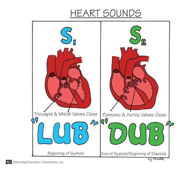 <p>closure of the tricuspid and mitral valves at the beginning of systole</p>