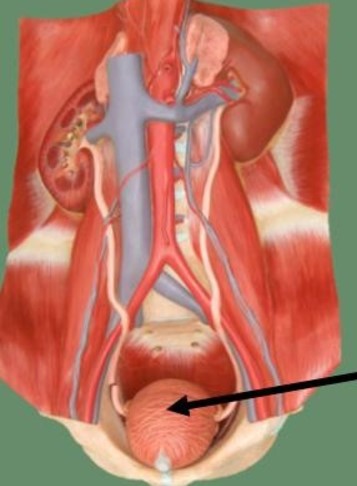 <p>What structure is indicated by the black arrow</p>