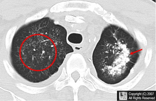 <p>What calcification is this? </p>