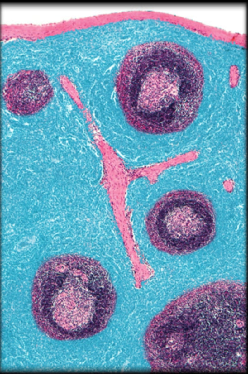 <p>Spleen</p>