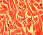 <p>Location and function of dense irregular connective tissue</p>