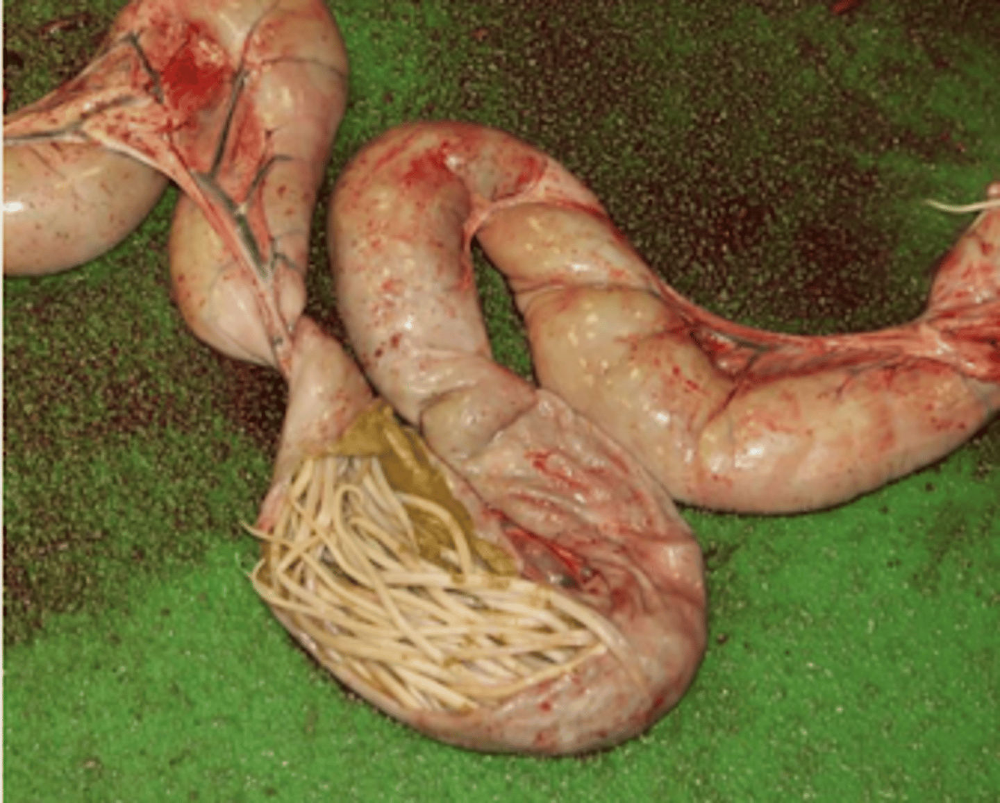 <p>¿patología?</p>