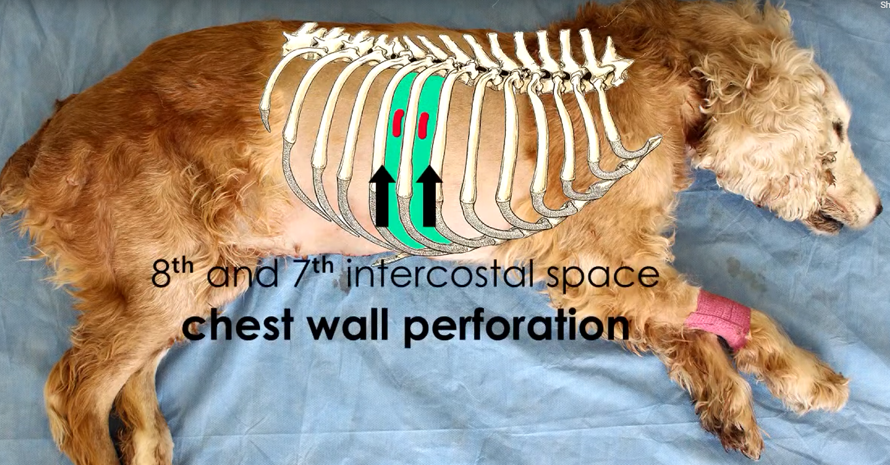 <p>Patient preparation when using the Seldinger Technique </p>