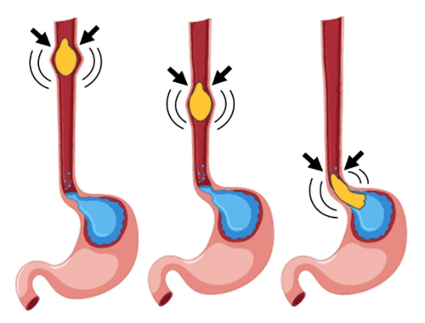 <p>the rippling motion of muscles in the digestive tract that mixes food with gastric juices to form a thin liquid</p>