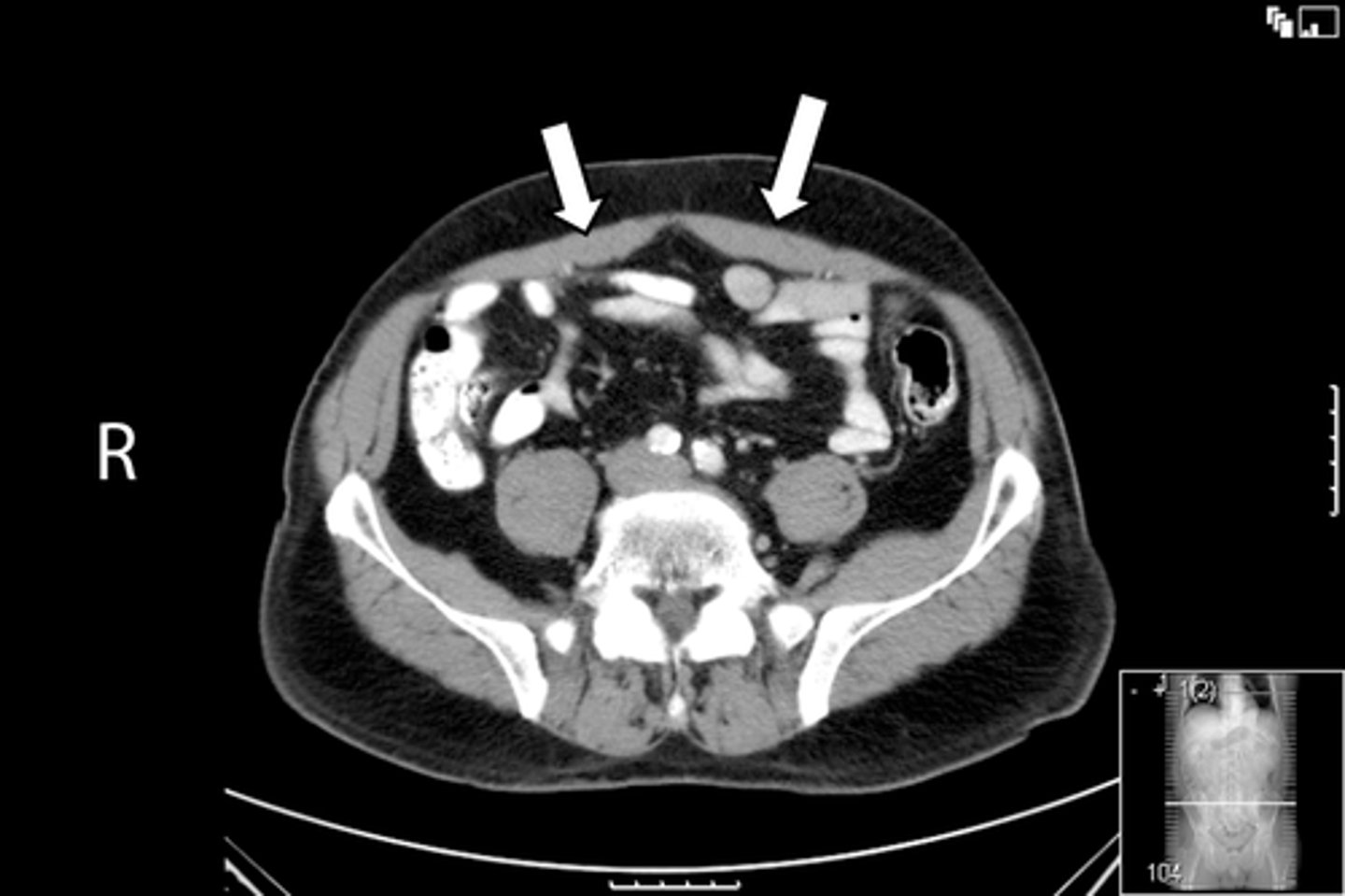 <p>What is indicated in the image?</p>