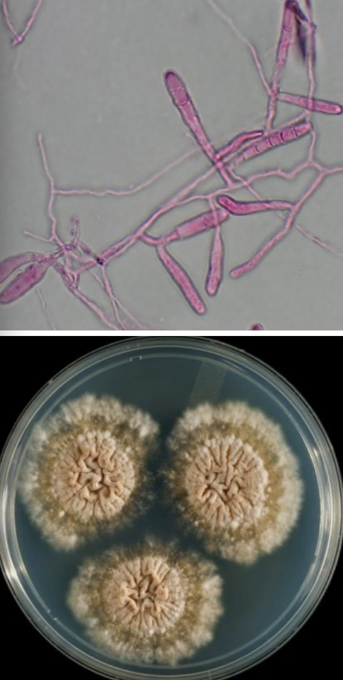 <p>Epidermophyton floccosum</p>