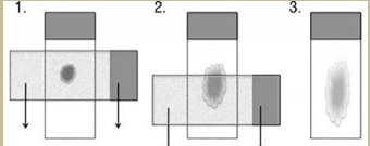 <ul><li><p><span><span>Simple and often preferred method</span></span></p></li><li><p><span><span>Excellent for semisolid, mucoid and viscous materials and small volume samples </span></span></p></li><li><p><span><span>The sample is expelled from the needle, in the middle of the slide </span></span></p></li><li><p><span><span>A second slide is placed at right angles to the first slide, on top of the sample, with an overlap either side</span></span></p></li><li><p><span><span>Second slide is then pulled along the lower slide, spreading the sample</span></span></p></li><li><p><span><span>Contact must be maintained, and the slides must be parallel to one another</span></span></p></li><li><p><span><span>Downwards pressure should be avoided to prevent cell damage</span></span><span style="font-family: "Calibri Light";"><span> </span></span></p></li></ul><p></p>