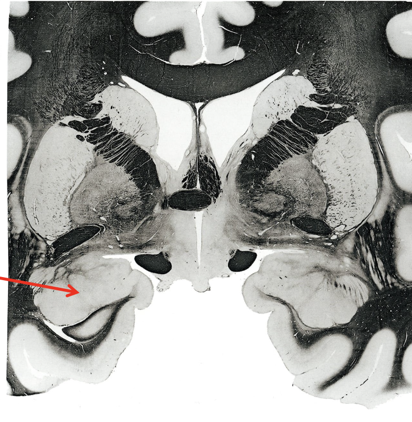 <p>what is the arrow pointing to?</p>