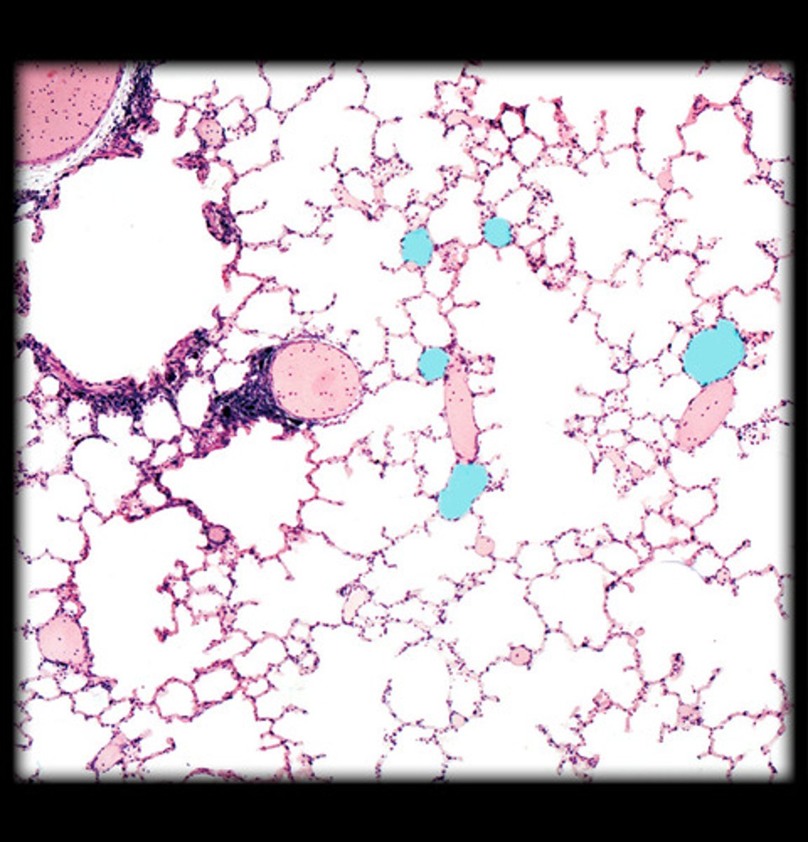 <p>what is highlighted HM in this image?</p>