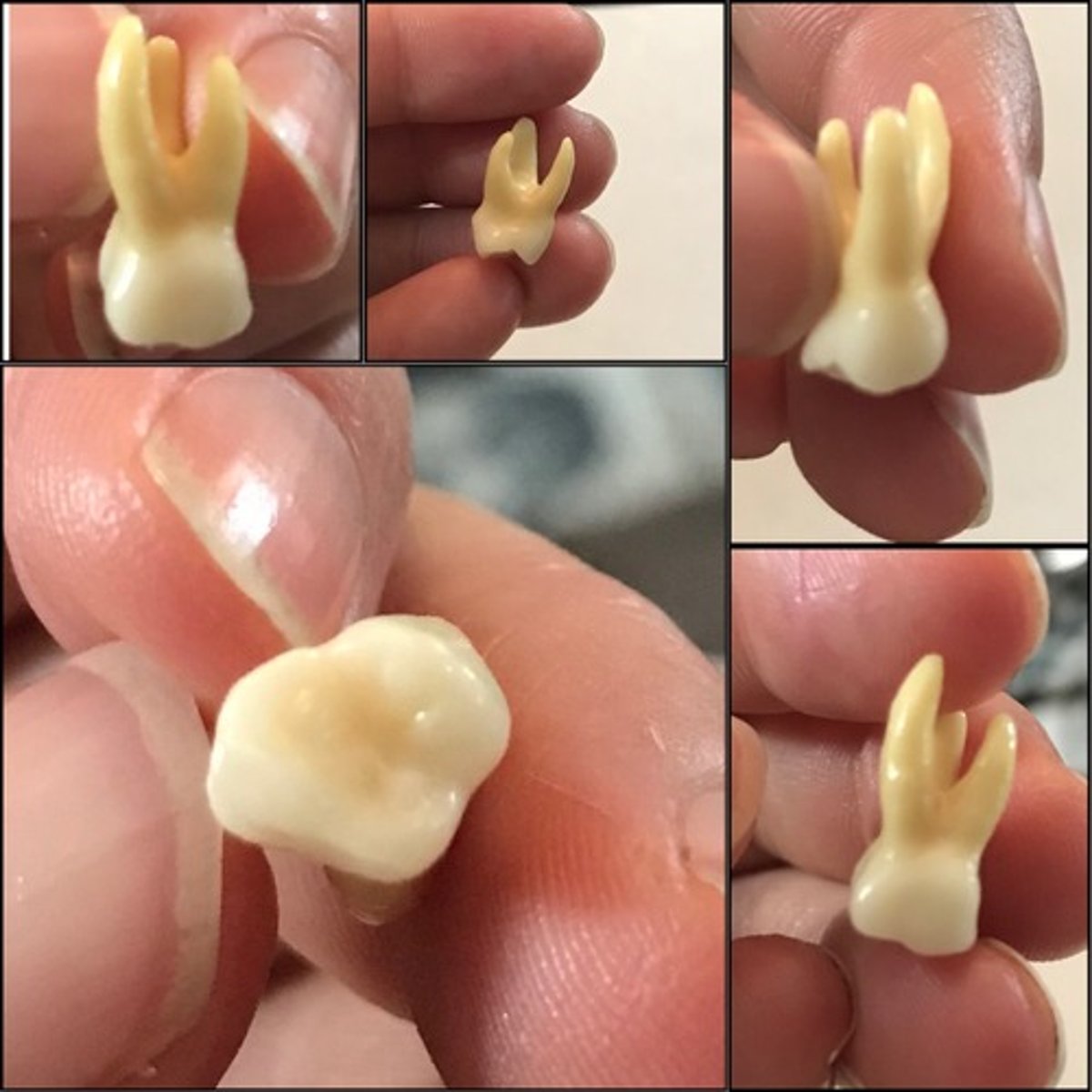 <p>What tooth is this ?</p>