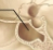 <ul><li><p>A type of opening</p></li><li><p>Hollow space within a bone</p></li></ul><p></p>