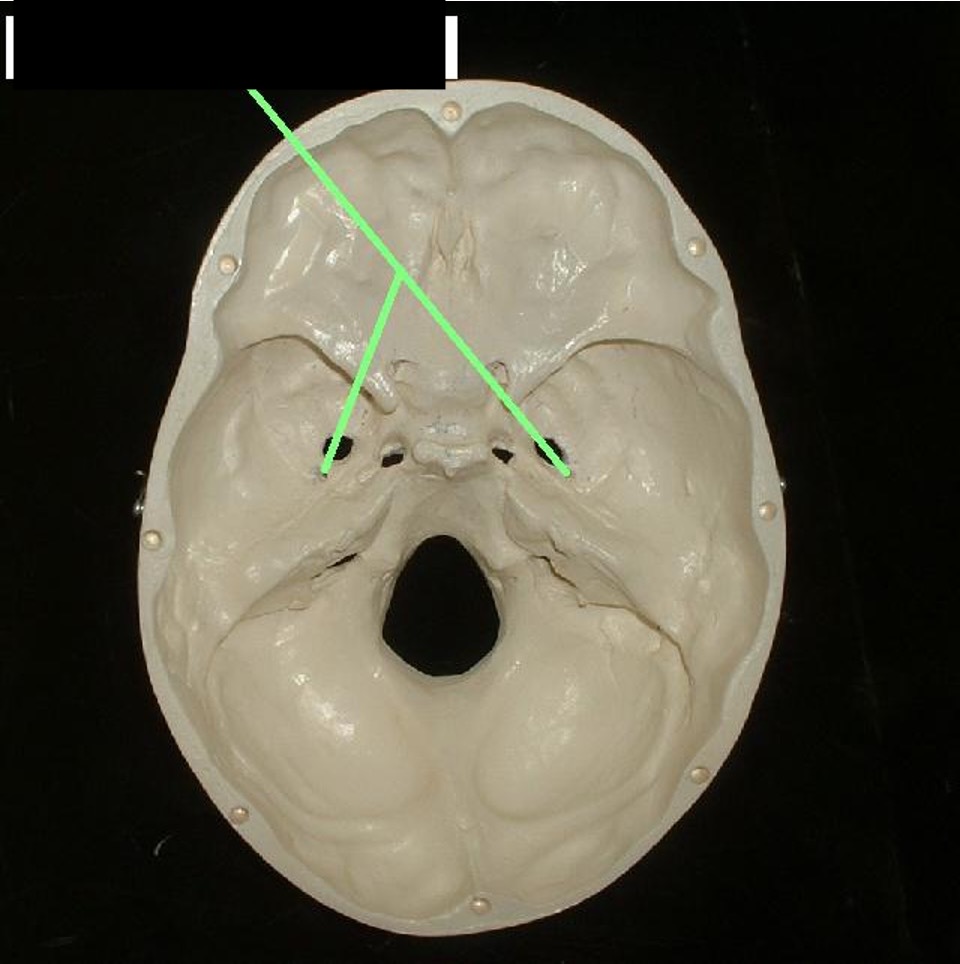 <p>a small hole that is next to the foramen ovale.</p>