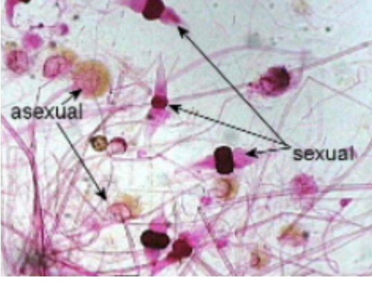 <p>rhizopus</p>