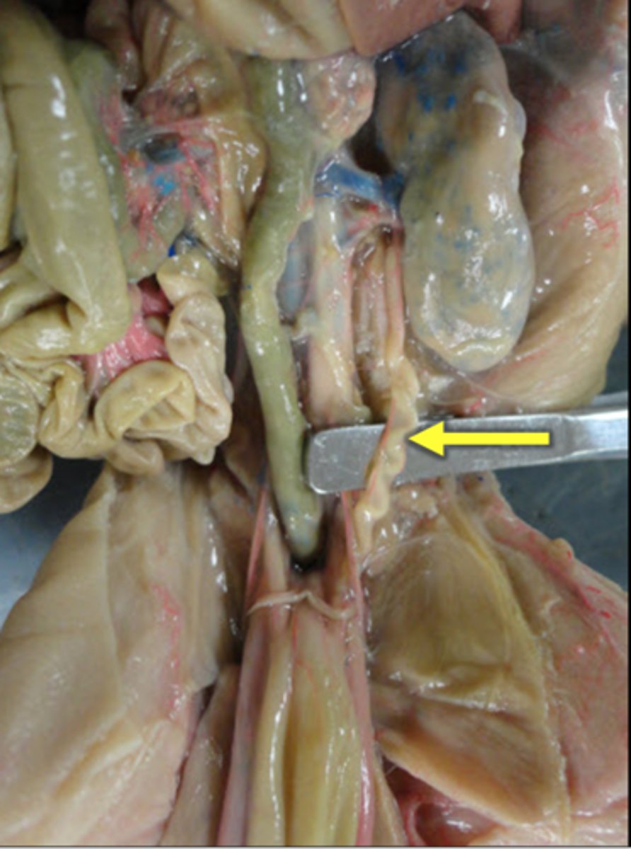 <p>Ureters</p>