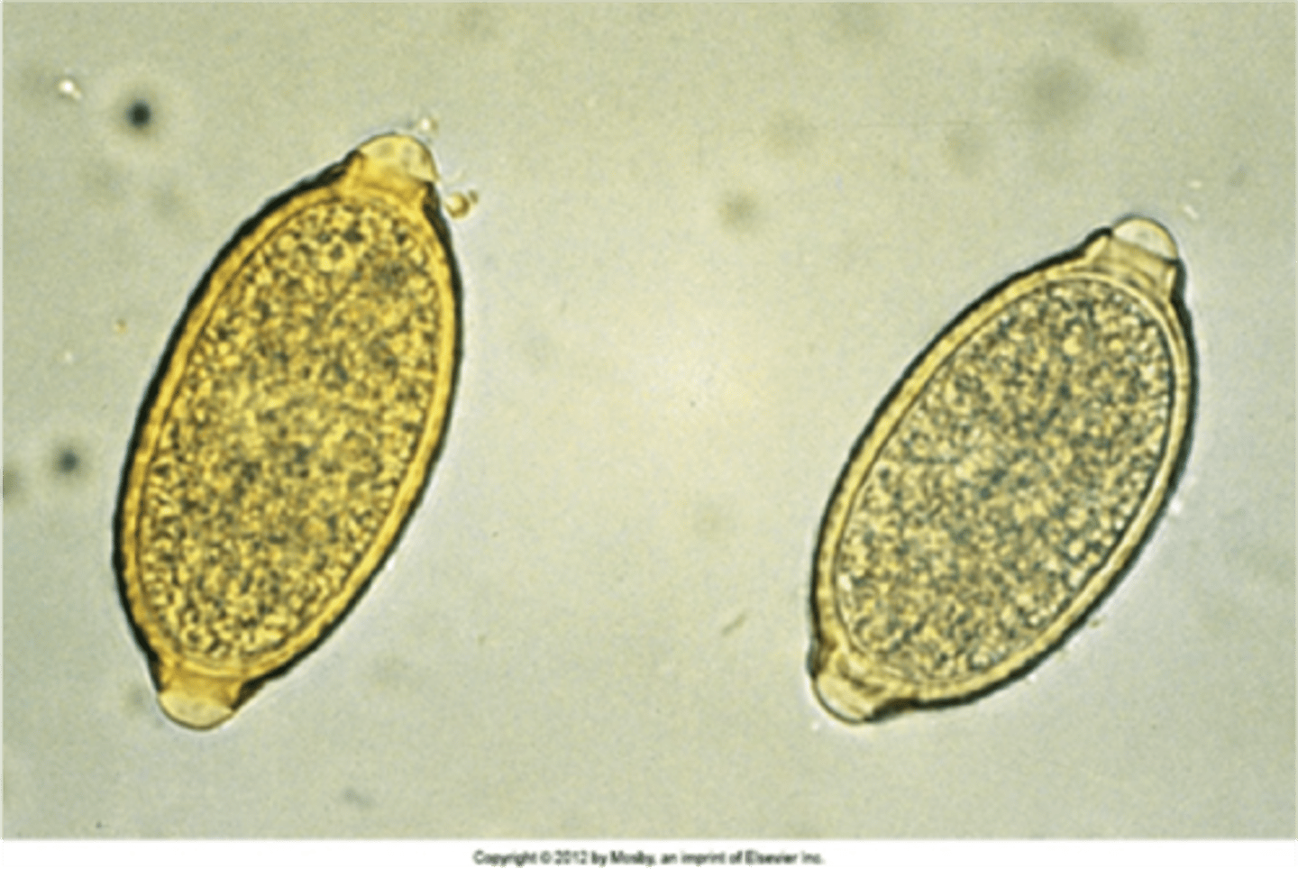 <p>respiratory capillarid - smaller than whipworm eggs</p>