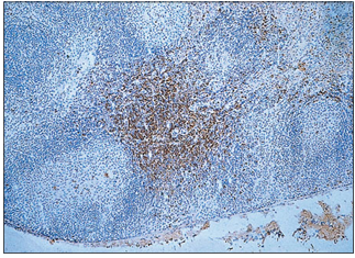 <p>name of histologic slide:</p><p>Stain used:</p>