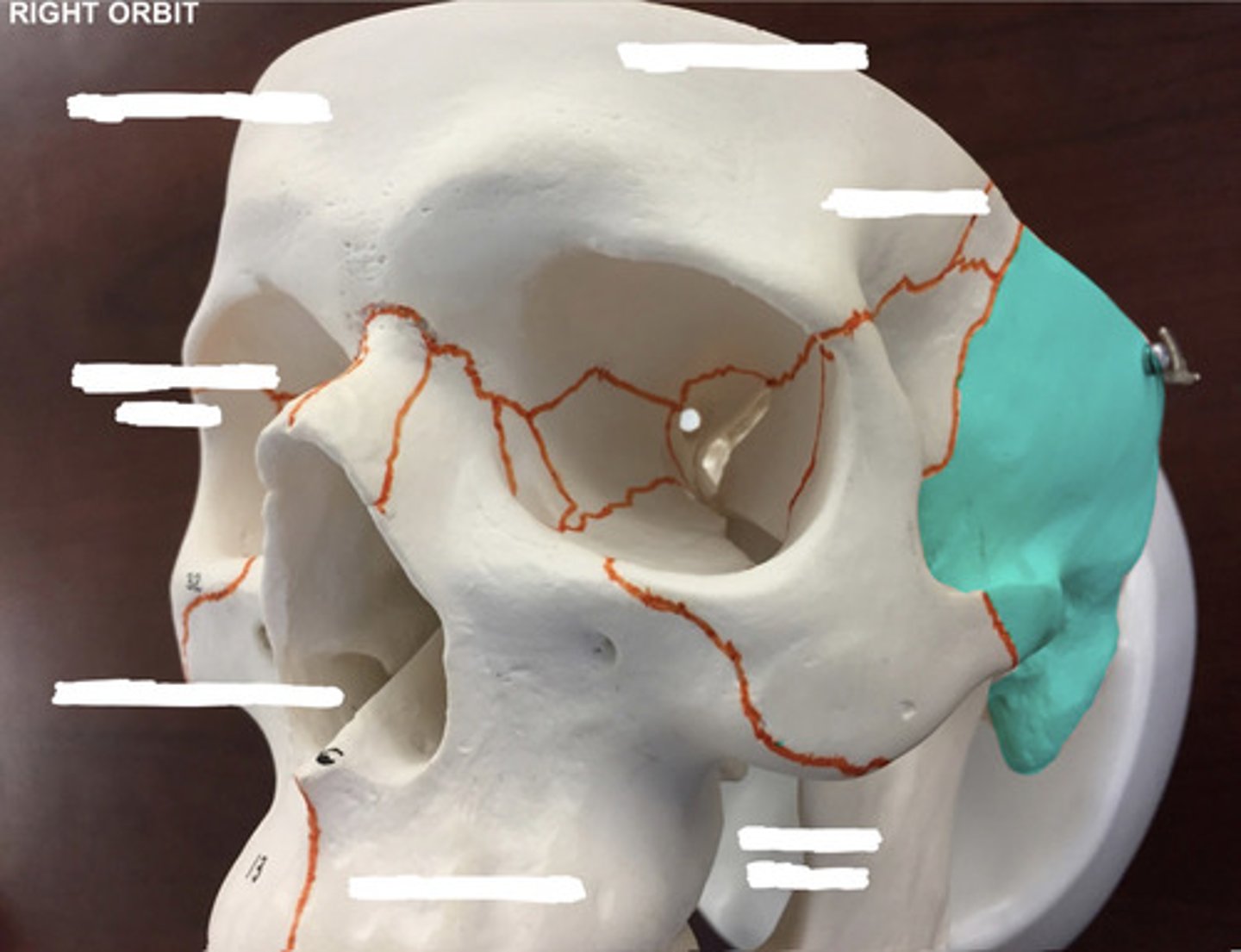 <p>What bone is highlighted here?</p>