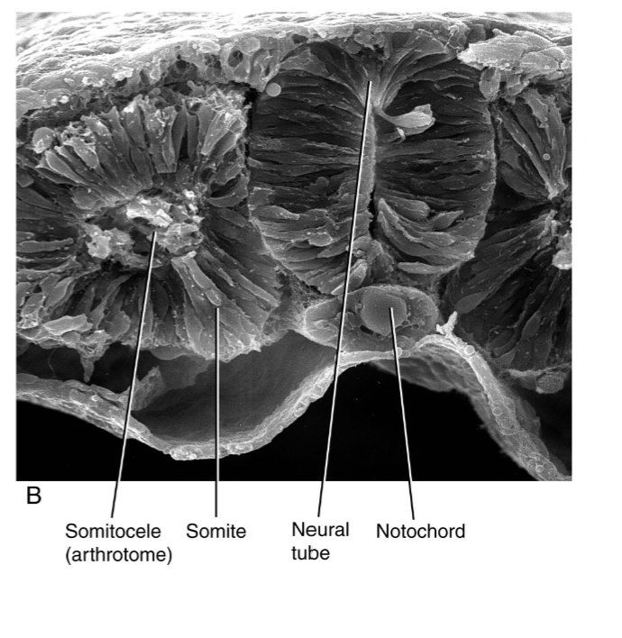 <p>Newly found somites have epithelial outer layer and a mesenchymal core, the <span><strong>somitocele.</strong></span></p><p></p>