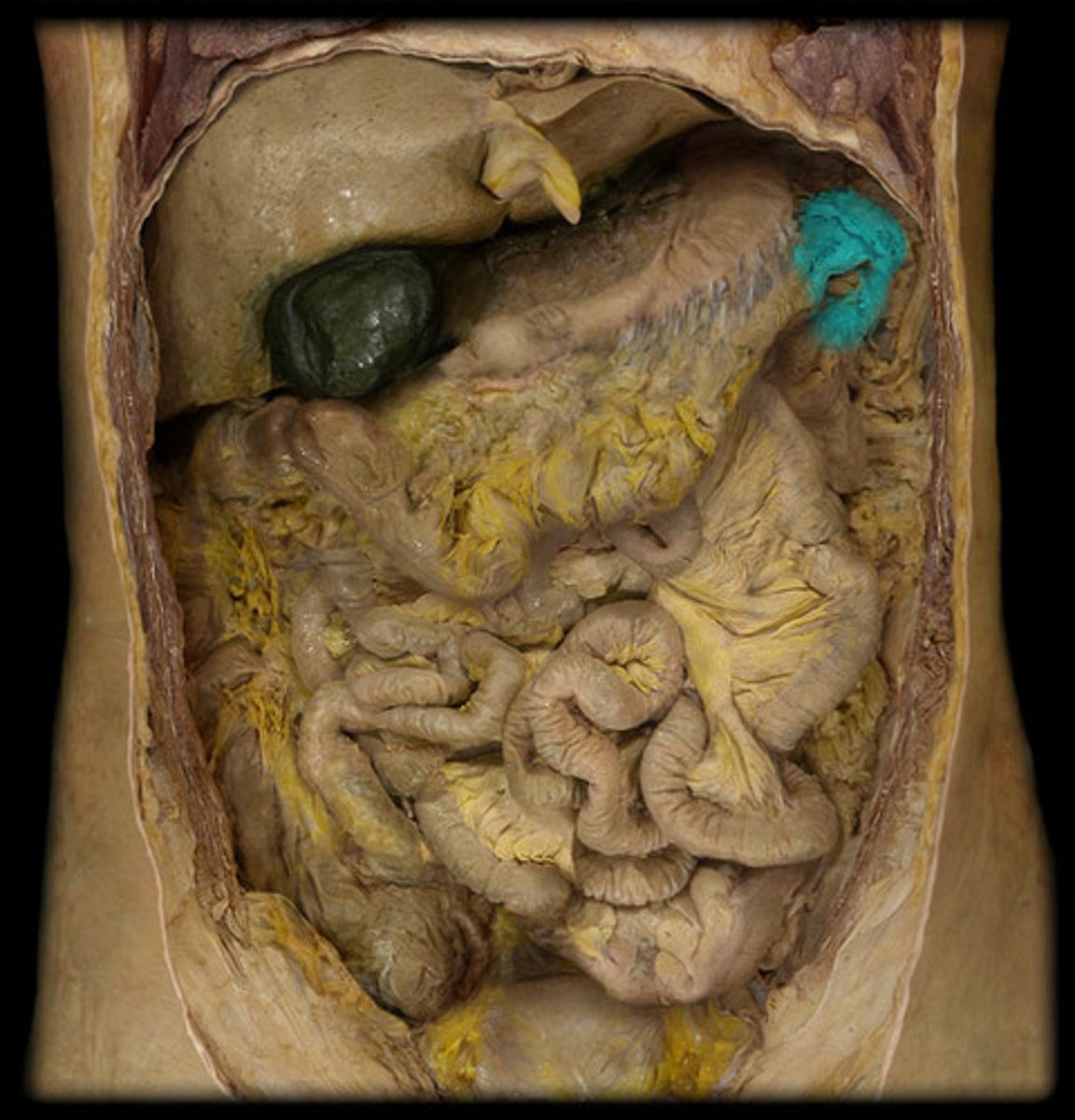 <p>The bend in the colon between the transverse and descending colon.</p>