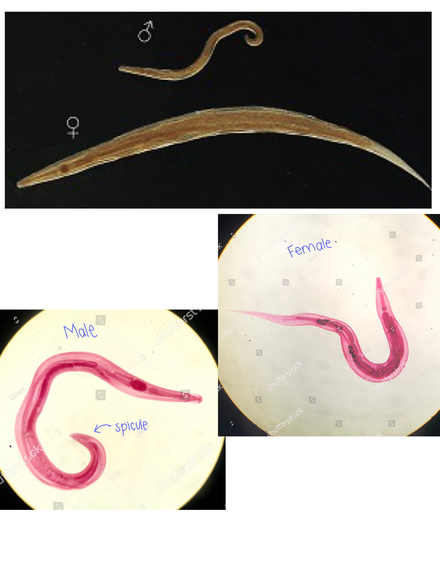 <p>Enterobius vermicularis adult </p>