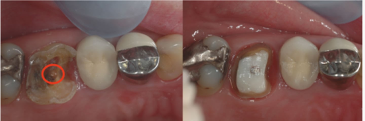 <p>What treatment do you suspect happened here?</p>
